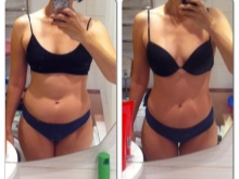 Charcot zuhany a karcsúsításhoz - előtte és utána képek