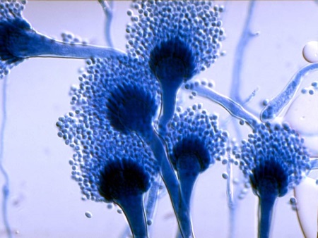 Houby v koupelně pod mikroskopem